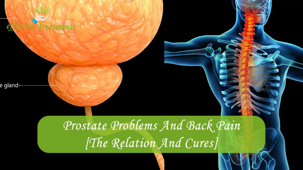 Can Prostate Cancer Cause Lower Back Pain