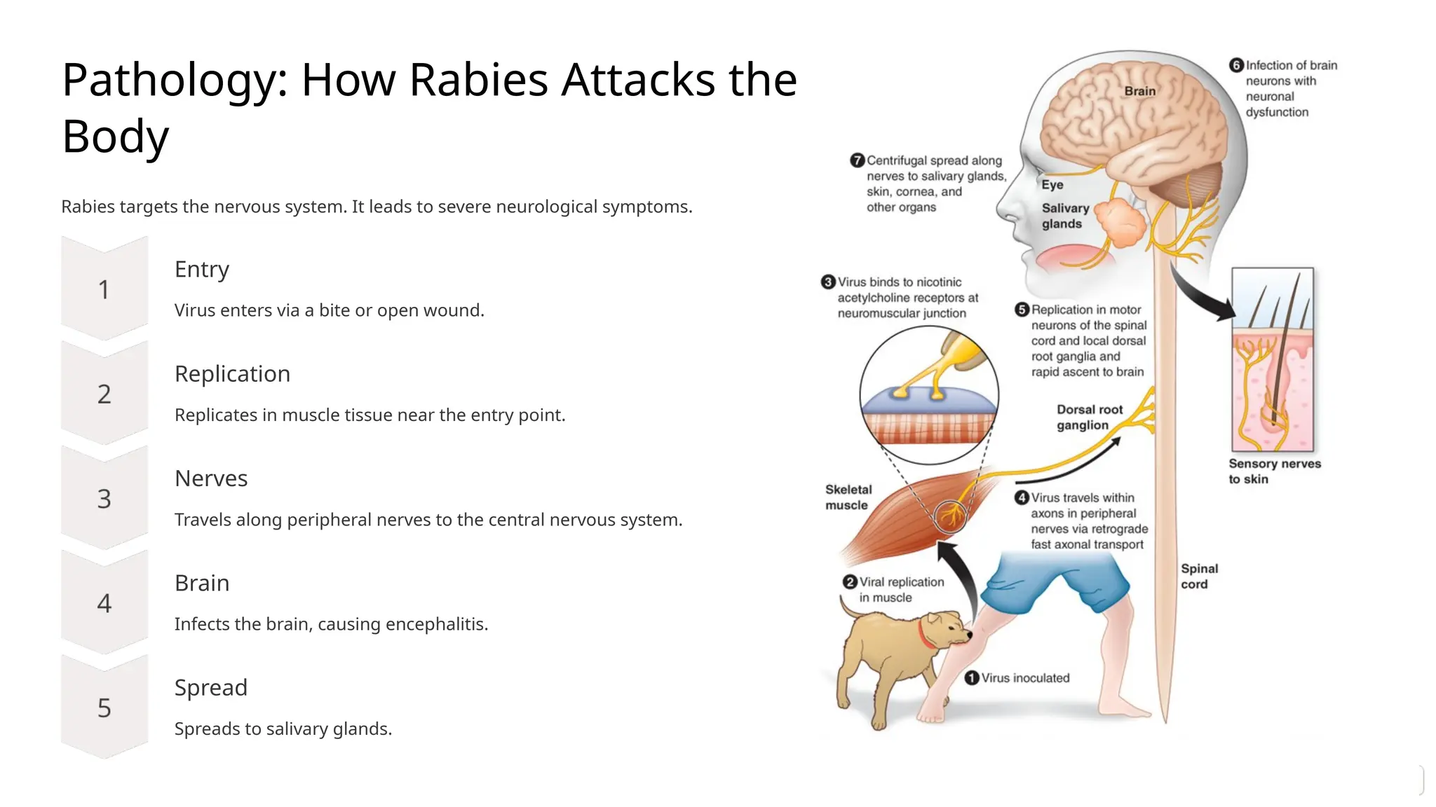 What Rabies Does to the Body
