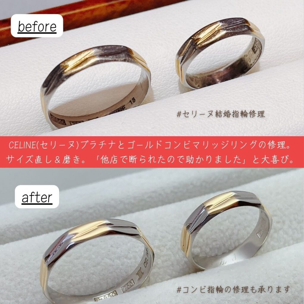 結婚指輪のサイズ直しはどこで頼む？費用相場や期間と後悔防ぐ極意