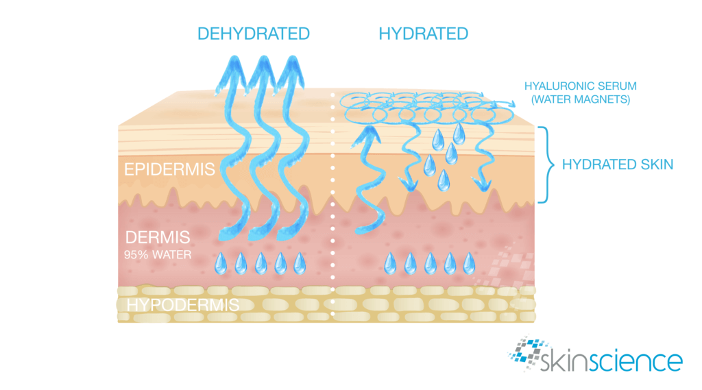 Does Soft Water Dry Your Skin