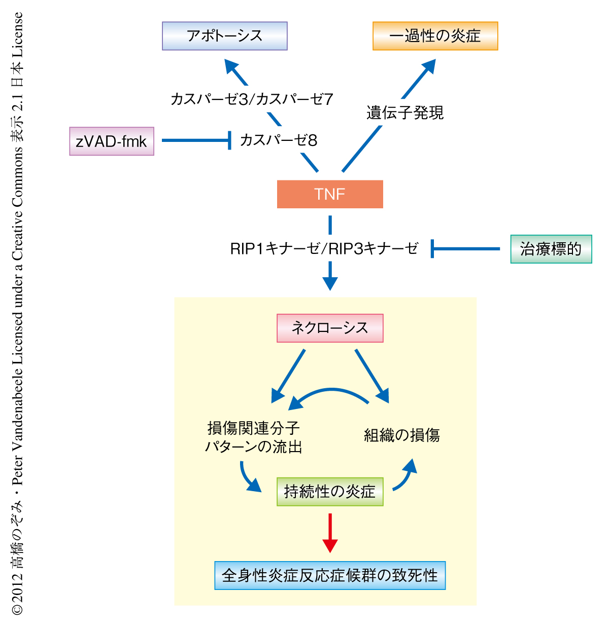 急変を招く全身性炎症反応症候群の正体｜敗血症との違いと最新診断基準