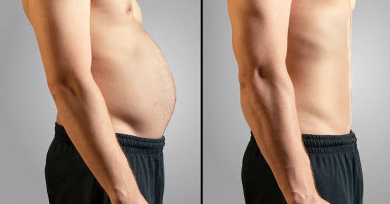 Water Retention Stomach Bloating