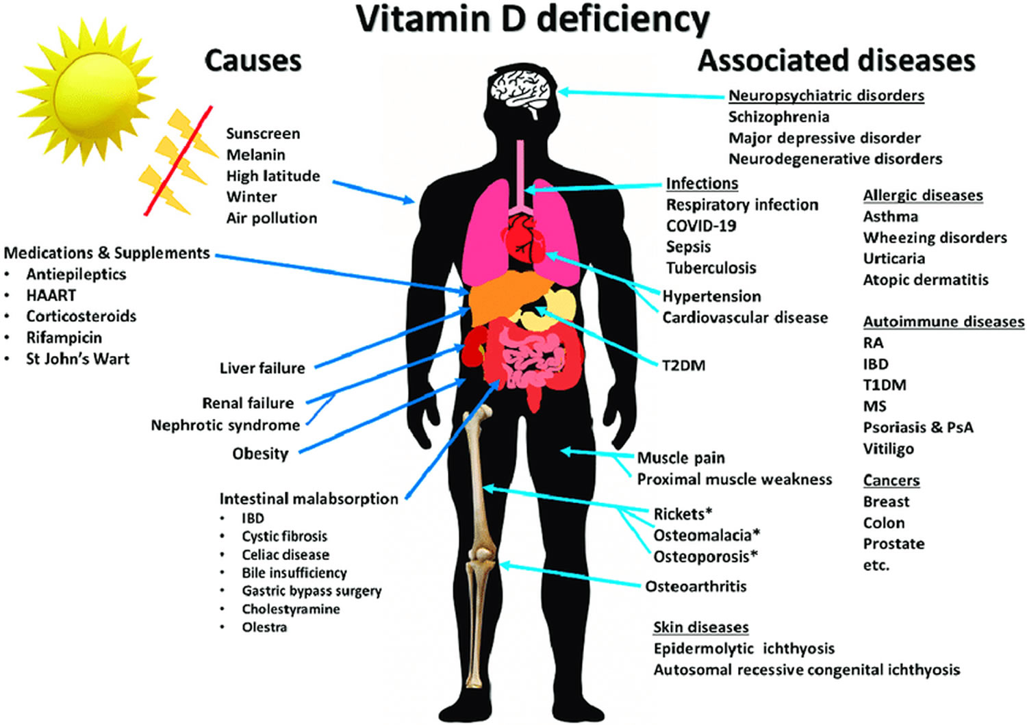 What Are the Symptoms for Lack of Vitamin D