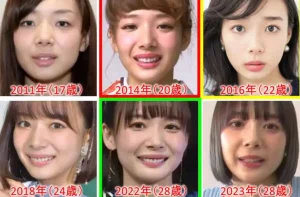 【動画まとめ】 岡田 紗 佳 整形 経歴＆学歴まとめ 2026 #781
