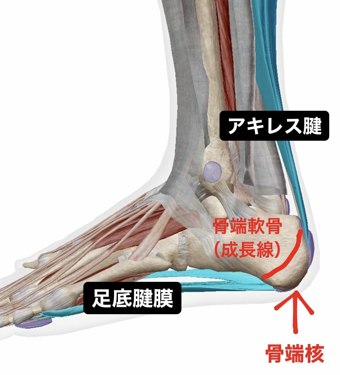 子どものかかと成長痛は放置厳禁！シーバー病の原因と即効ケア総まとめ