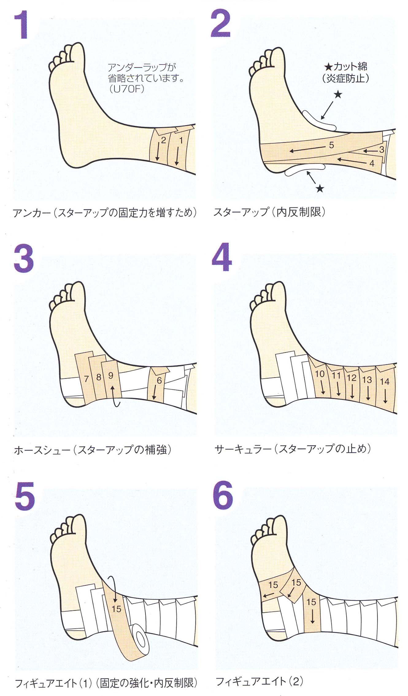 足親指の捻挫で歩けない？正しいテーピング巻き方と治し方を徹底解説
