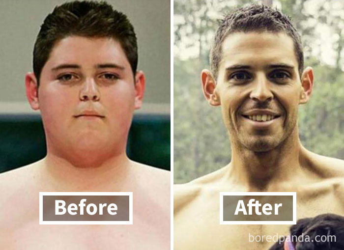 Before and After Weight Loss in Face