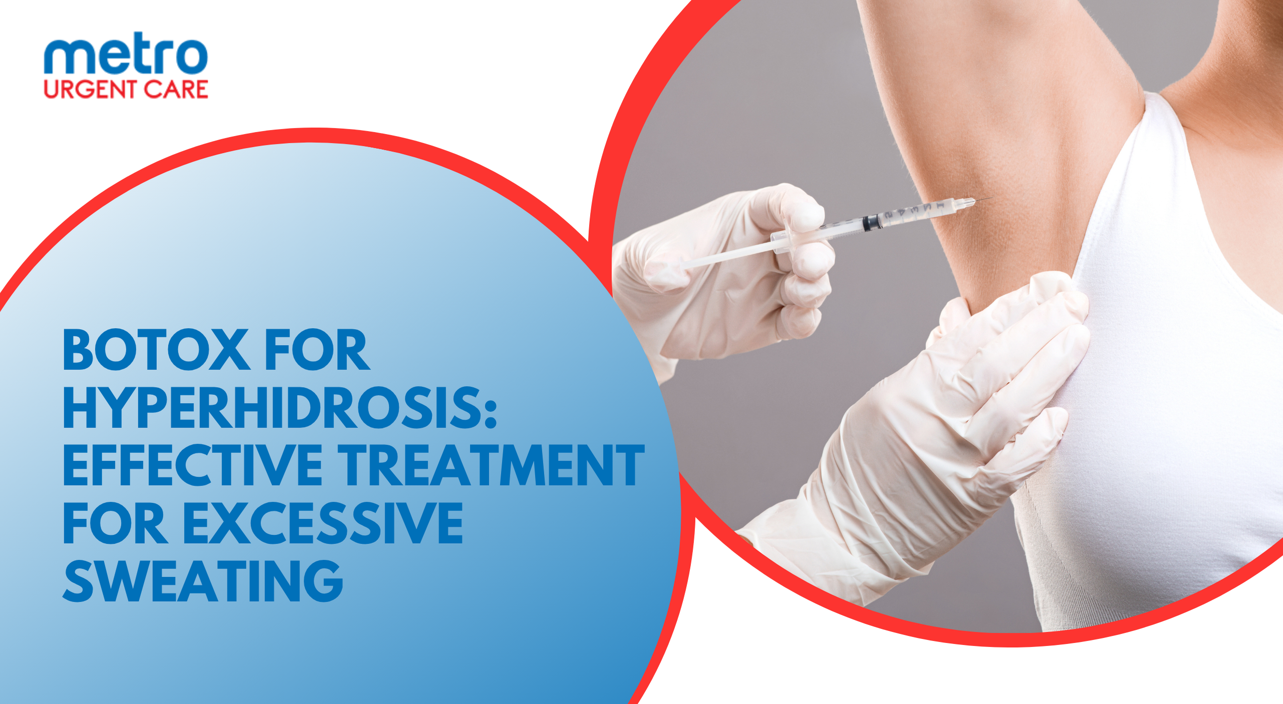 Hyperhidrosis Treatment Guide: Antiperspirants, Botox, and Surgery
