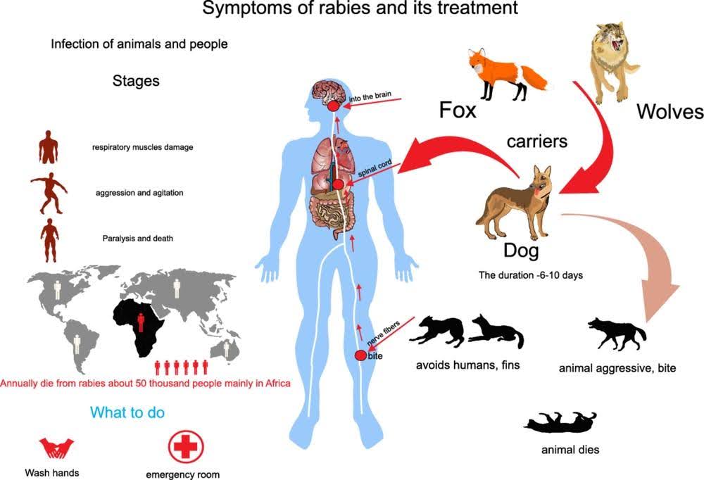 Human Affected by Rabies