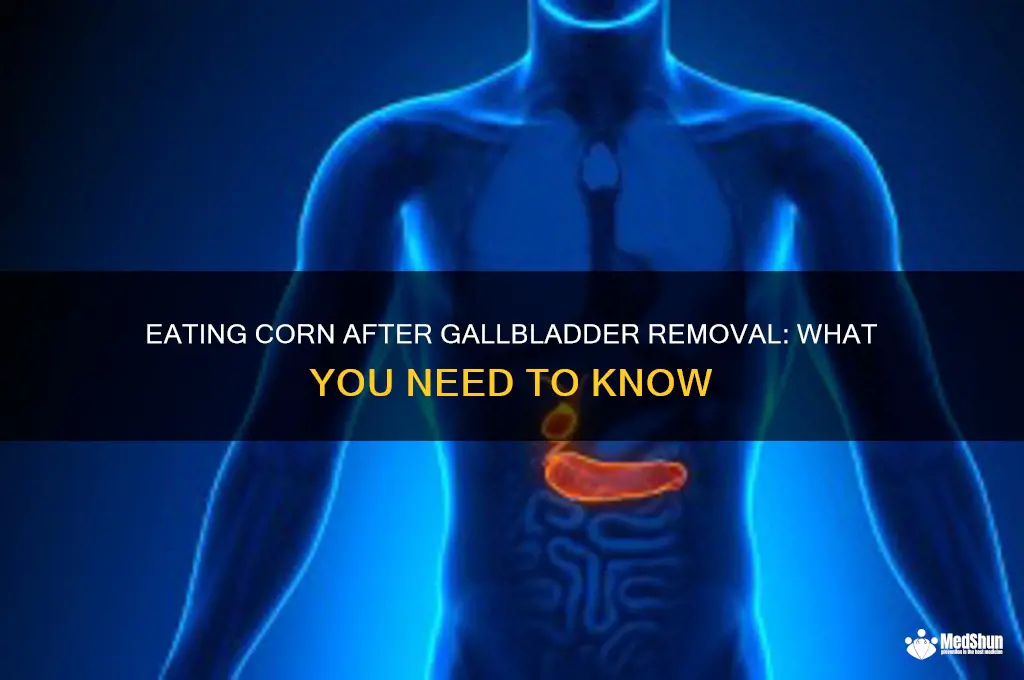 Can You Eat Corn After Gallbladder Surgery