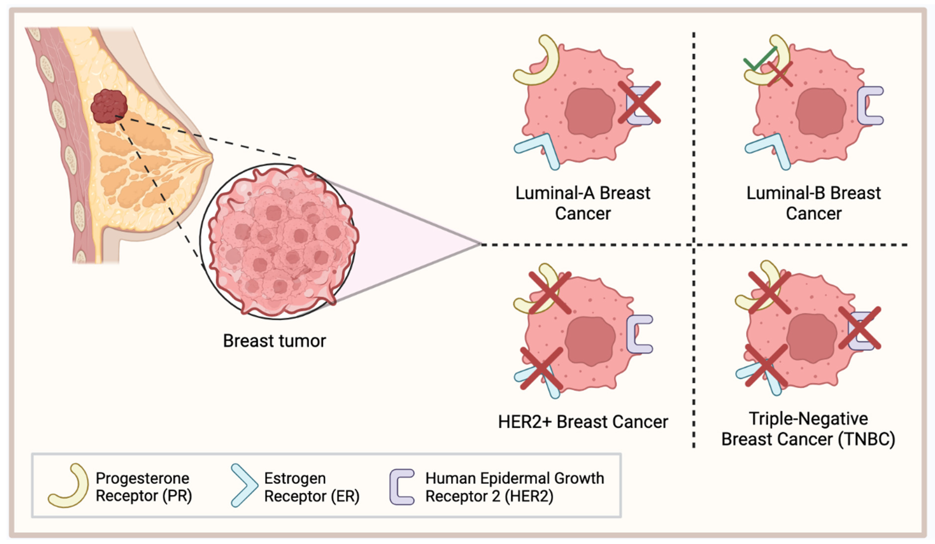 Hormone Negative Breast Cancer