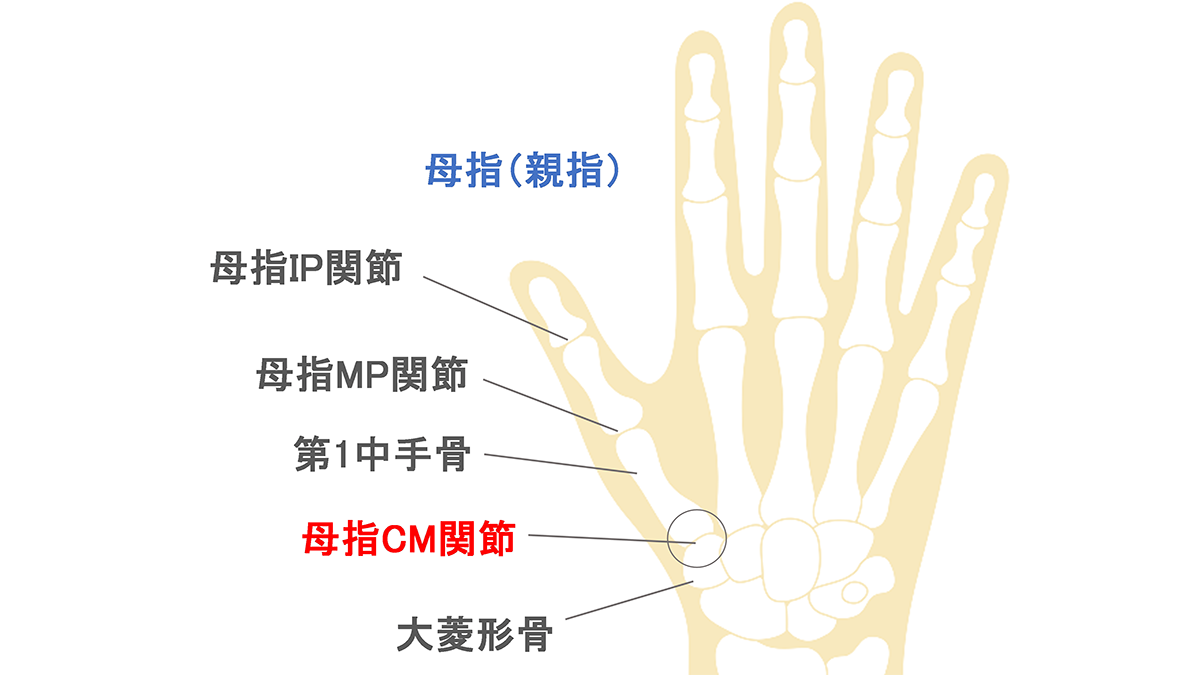 親指の付け根が痛むCm関節とは？腱鞘炎との違いと2026年最新治し方