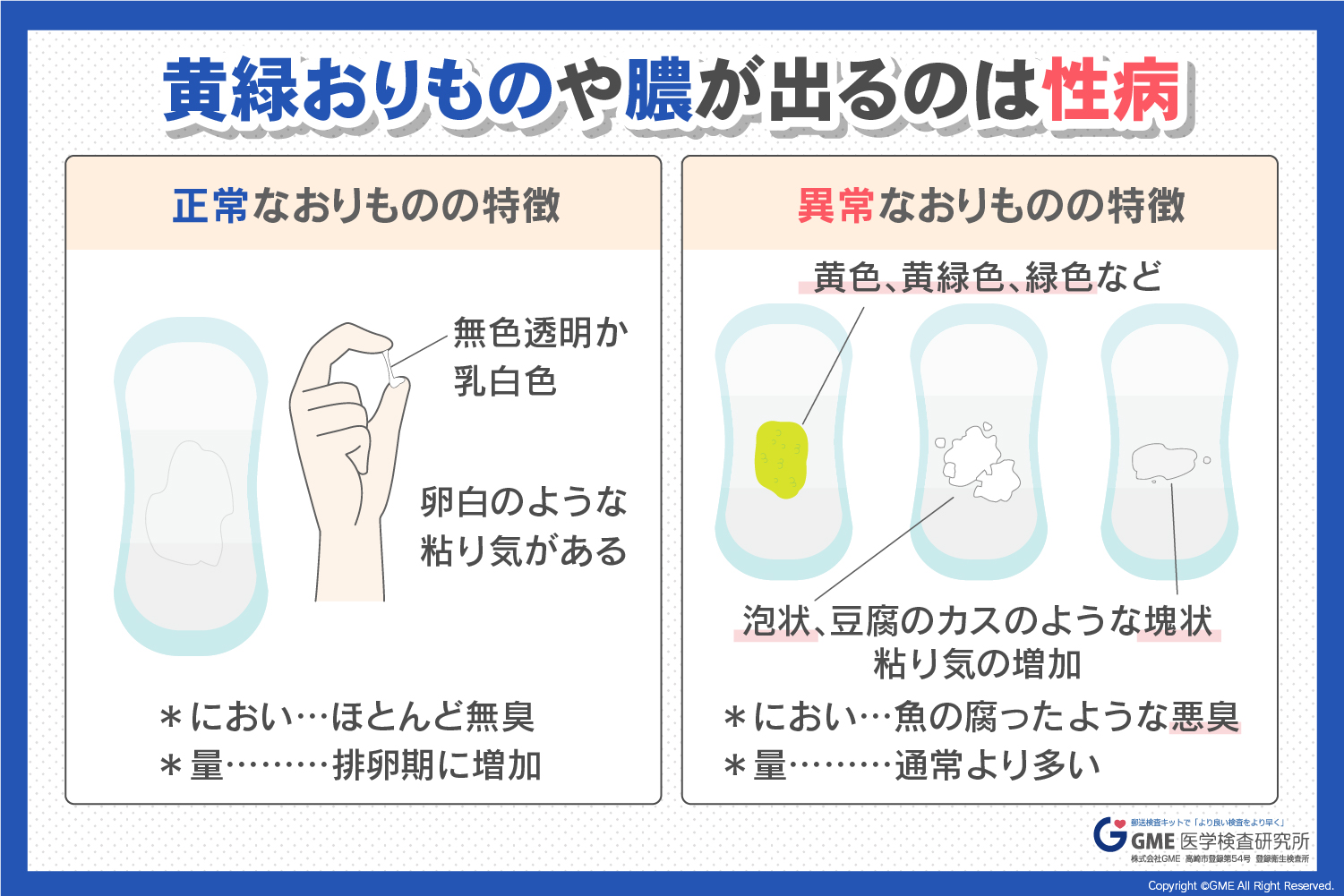 緑色のおりものは病気の警告？原因と受診の目安・最新治療を解説