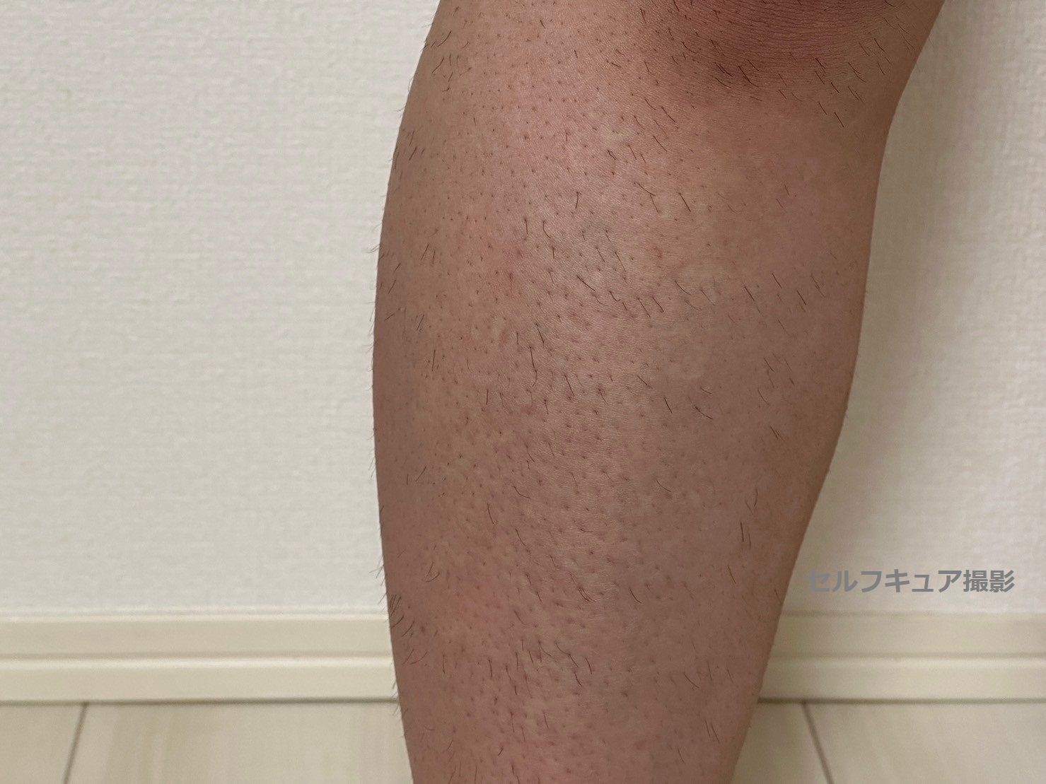 チョコザップ脱毛効果の真相！効果ない噂の理由と回数・期間を徹底検証