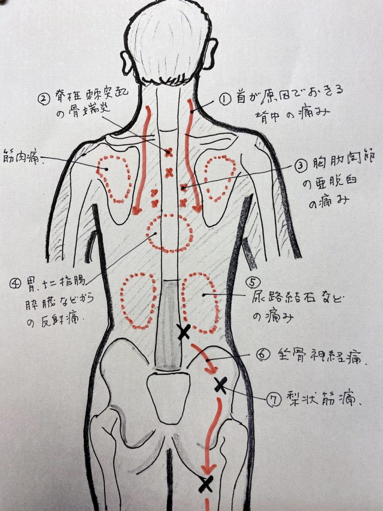 背骨がピンポイントで痛い原因は？叩くと響く危険サインと受診目安