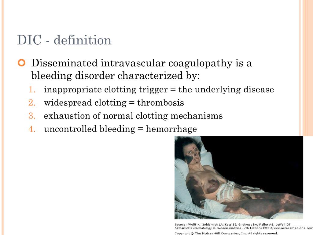 What Is D I C in Medical Terms