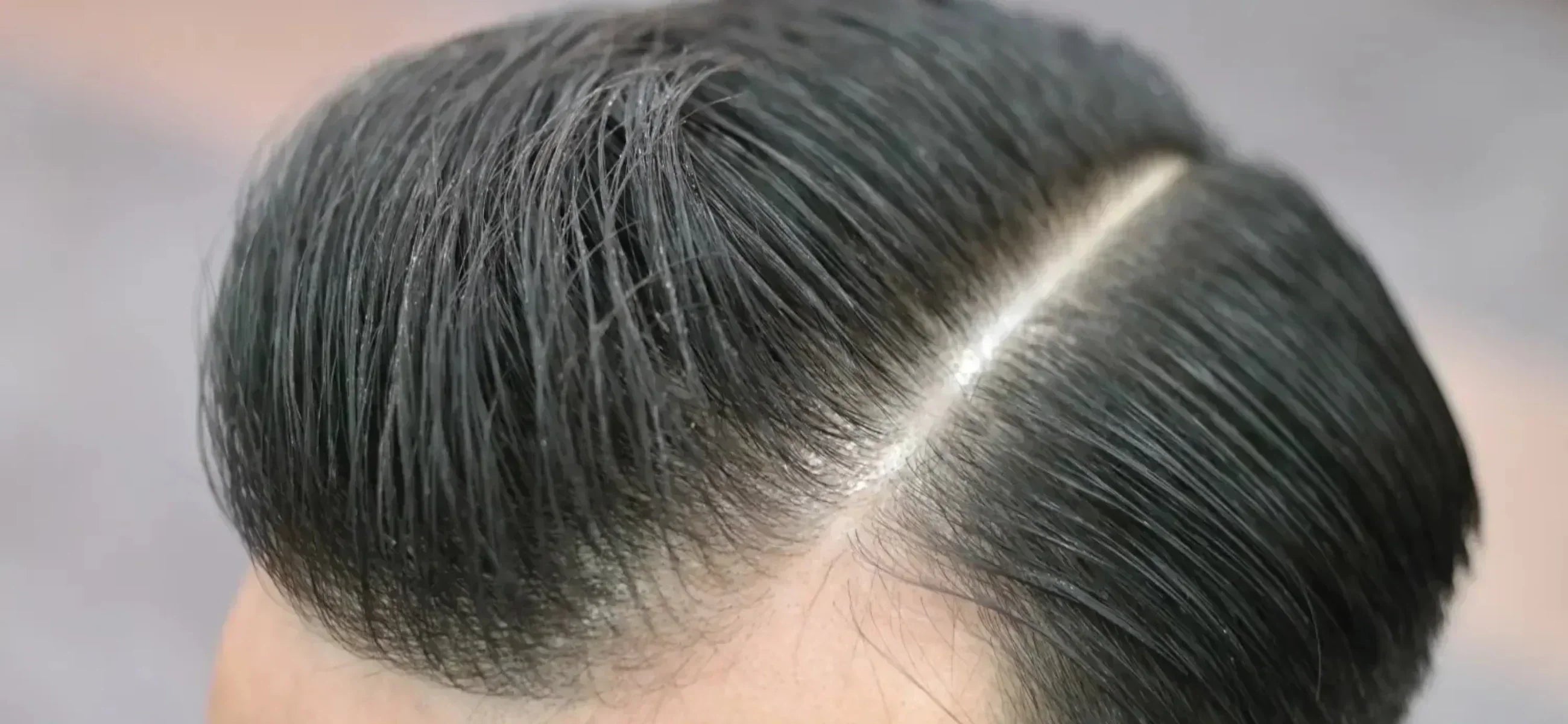 Does Pomade Cause Baldness