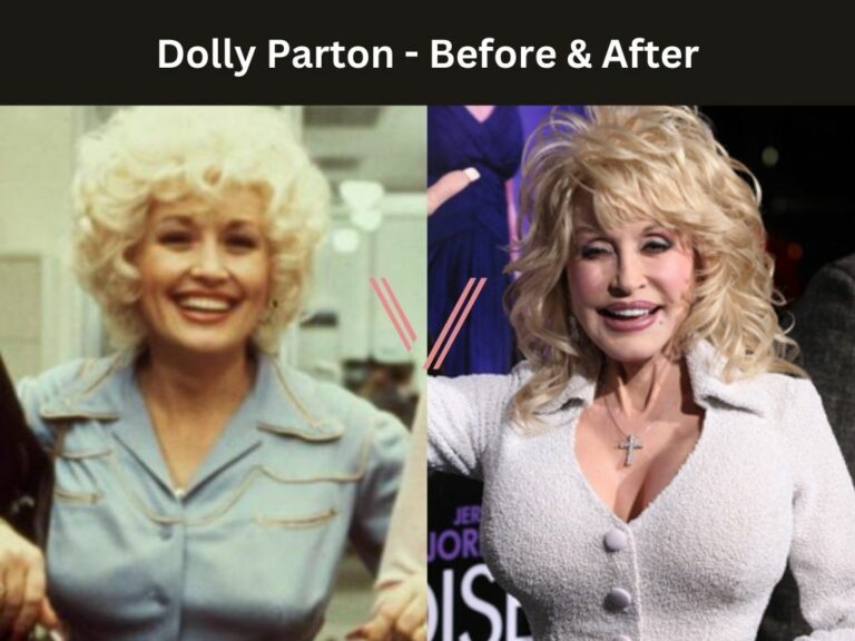 How Did Dolly Parton Did