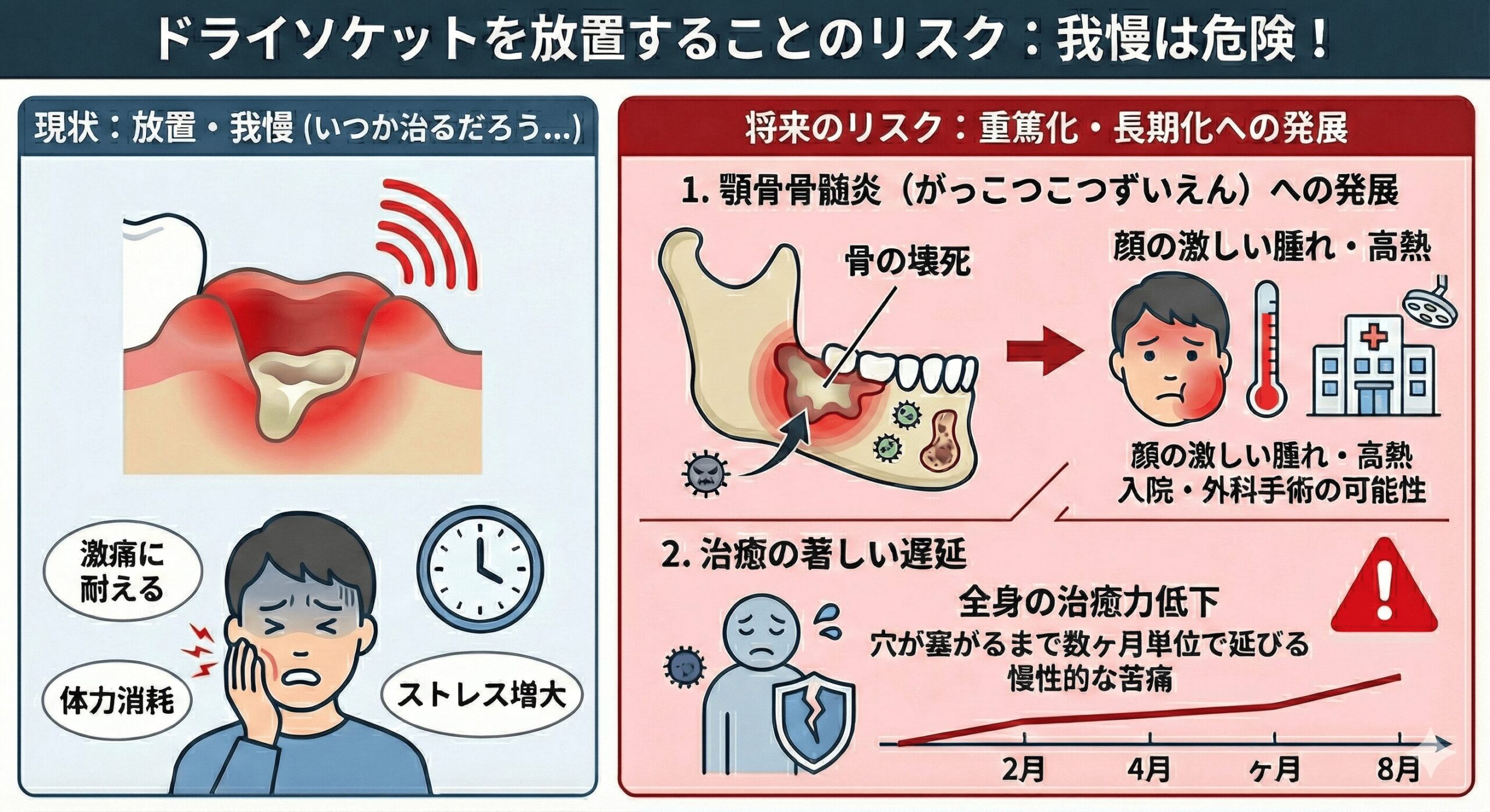 抜歯後の白い穴は危険？ドライソケットを見た目と激痛で見分ける真相