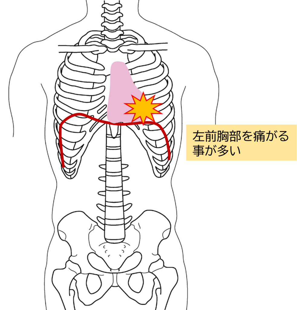 息を吸うと胸がチクッ！前胸部キャッチ症候群の正体と心臓病との違い