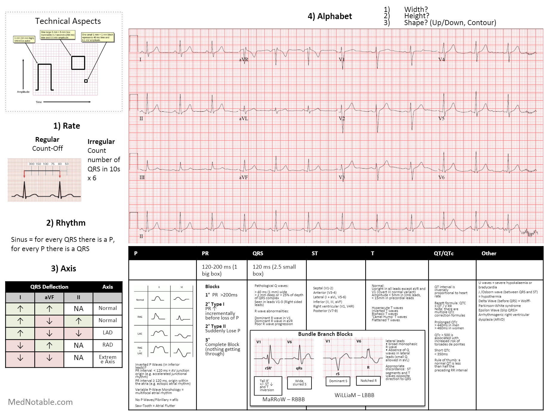 Clined-Corp-Adult Ecg Interpretation - Test B - Attempt #1