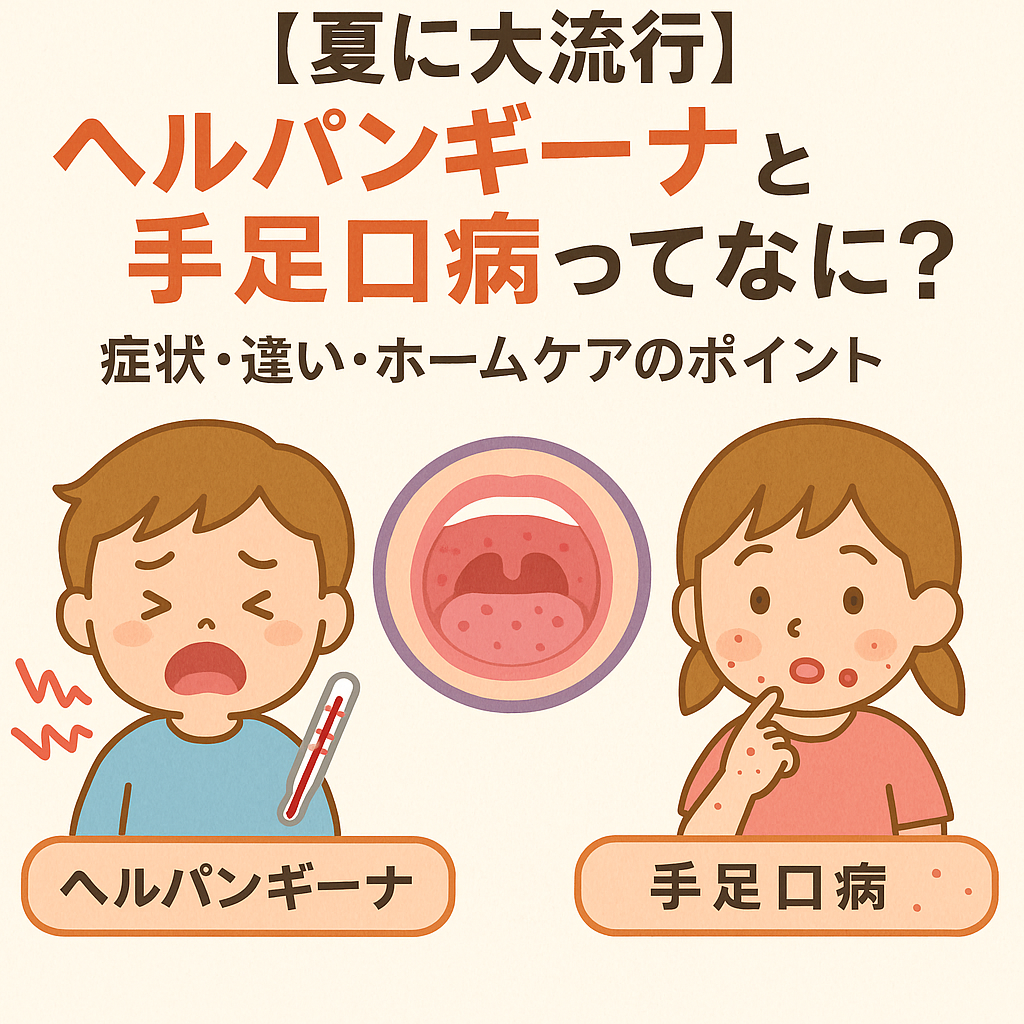 ヘルパンギーナから手足口病へ移行？連続感染の真相と2026年対策