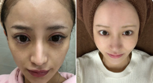 「憧れ」か「危険信号」か？愛沢えみりの激痩せ報道と、現代の美容シーンが直面する歪んだ美の基準