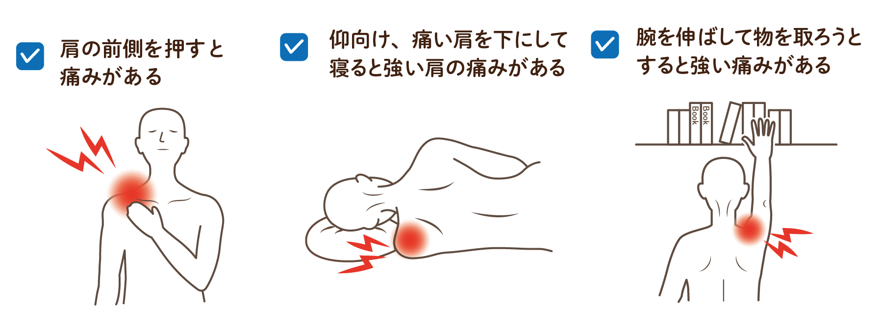 肩の痛みで病院は何科へ？受診目安と放置厳禁の重篤疾患を徹底解説