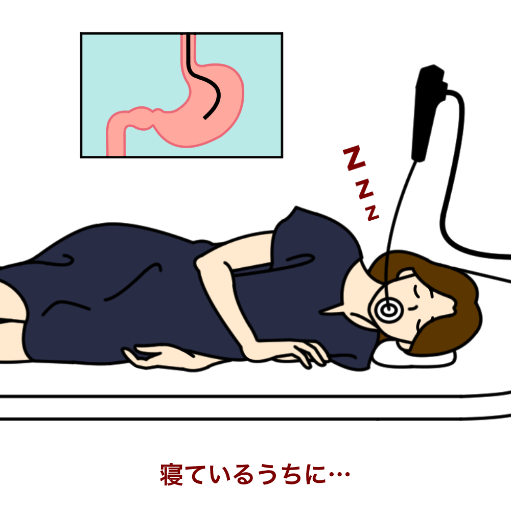 胃カメラの全身麻酔は安全？鎮静剤の違いと眠って受ける検査の真実