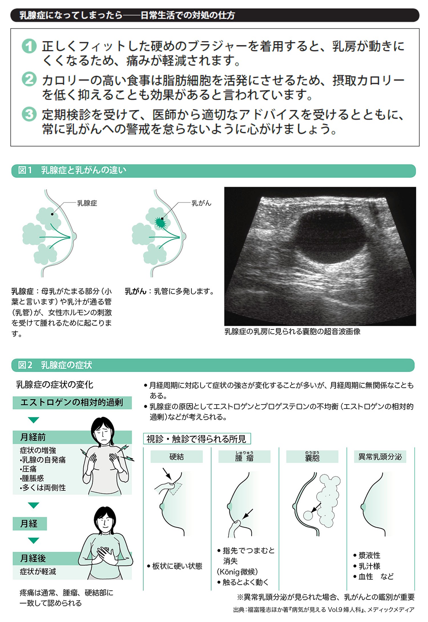 乳腺症とは？乳がんとの違いやしこりの特徴・受診目安を徹底解説