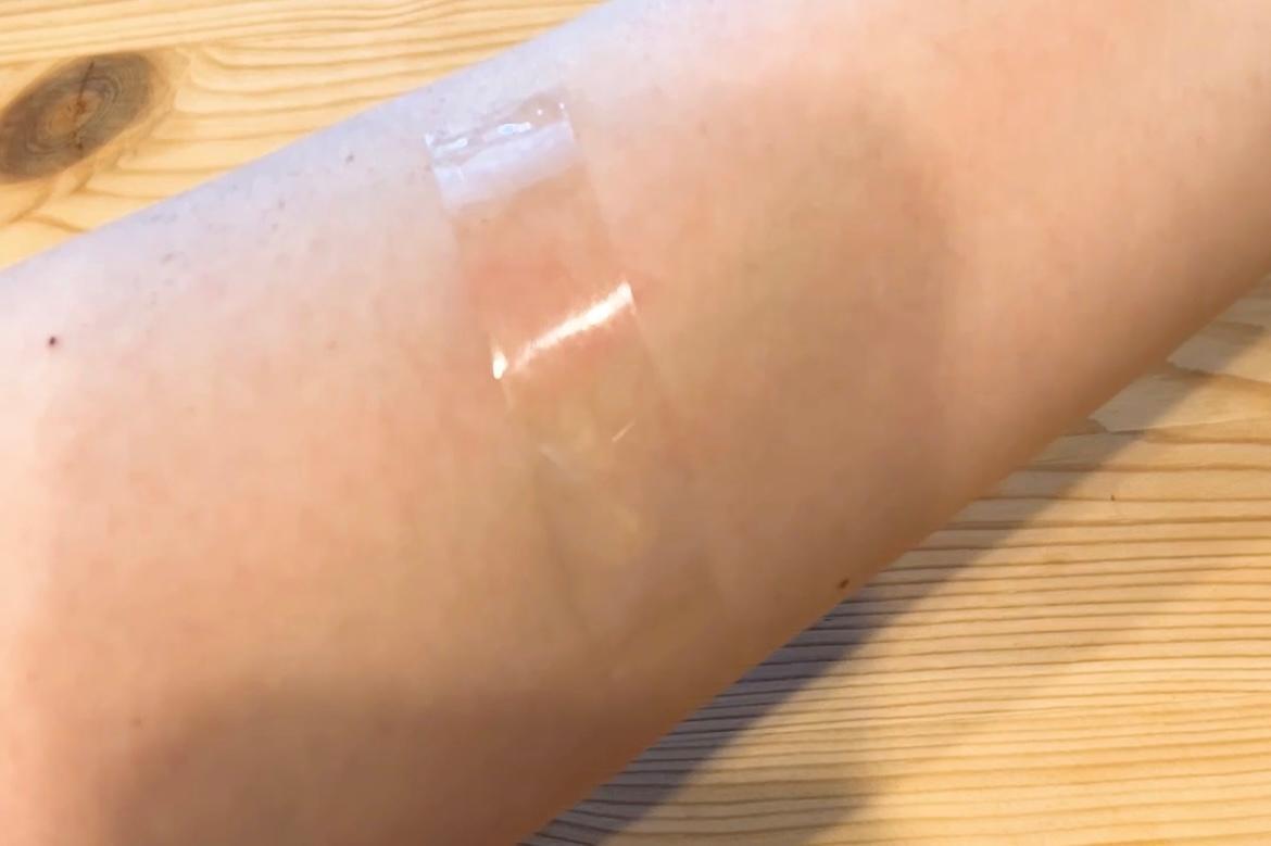 蚊刺されにセロテープは逆効果？痒みが消える噂の真相と危険性