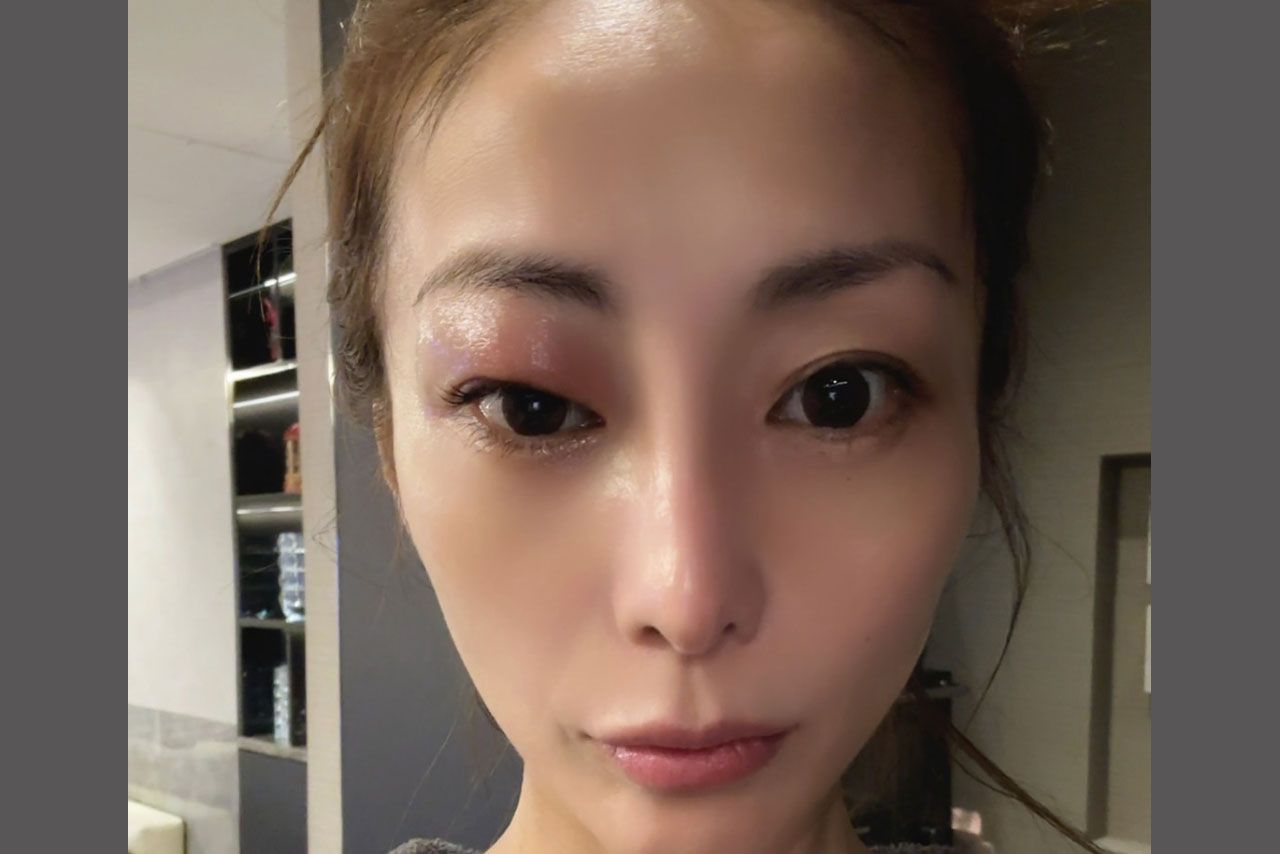 腫れぼったい目の芸能人はなぜ魅力的？垢抜けの真相と男女別一覧