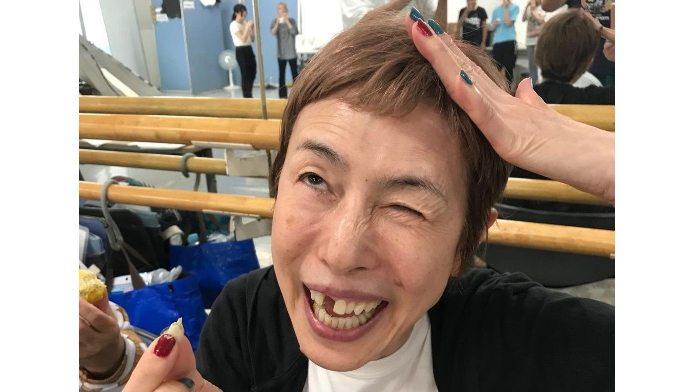 前歯が差し歯の芸能人まとめ！不自然な白さの理由と治療費の真相