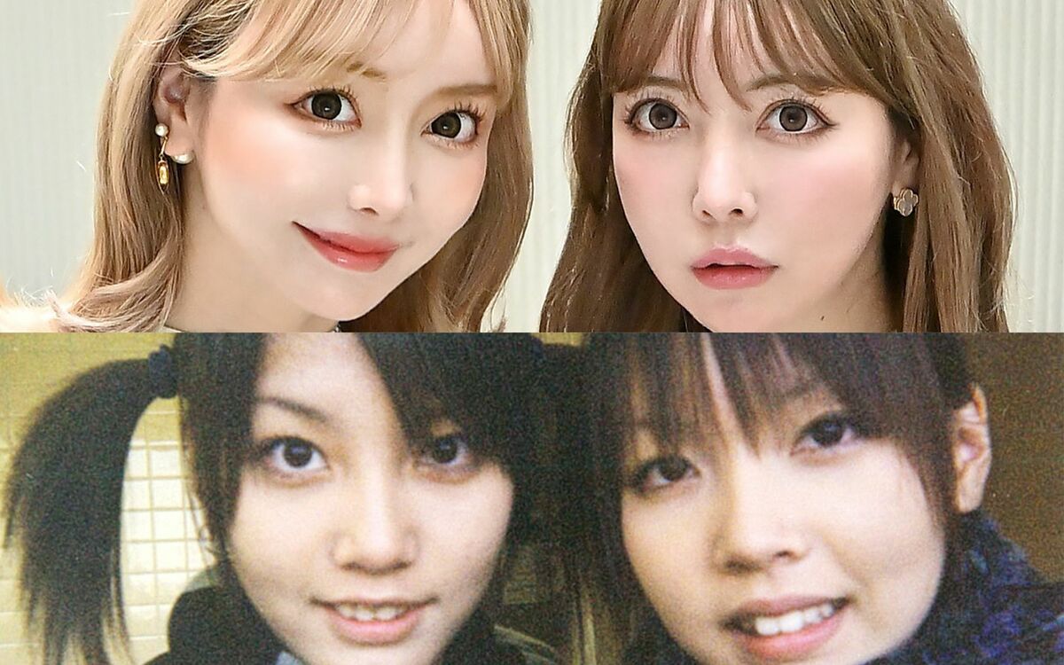 吉川ちえちかの現在と激変の軌跡｜整形総額や結婚の真相を徹底解剖