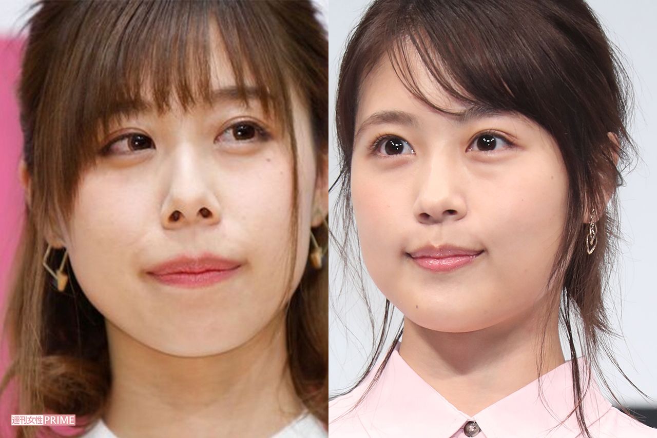 有村架純の姉・有村藍里の現在｜整形公表の真相と姉妹の絆【2026最新】