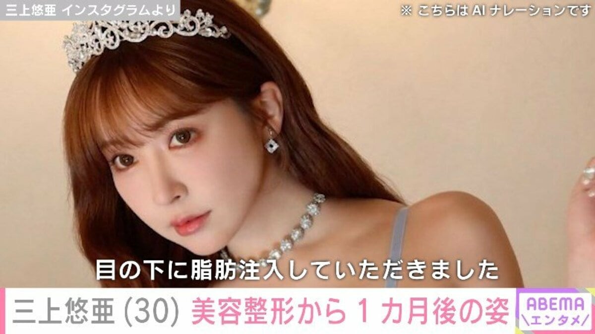 三上悠亜の整形疑惑を昔の写真と比較検証！施術箇所と美の真相【2026年最新】