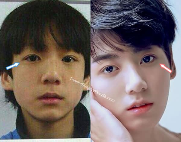 Bts v Jungkook Baby Face Before and After