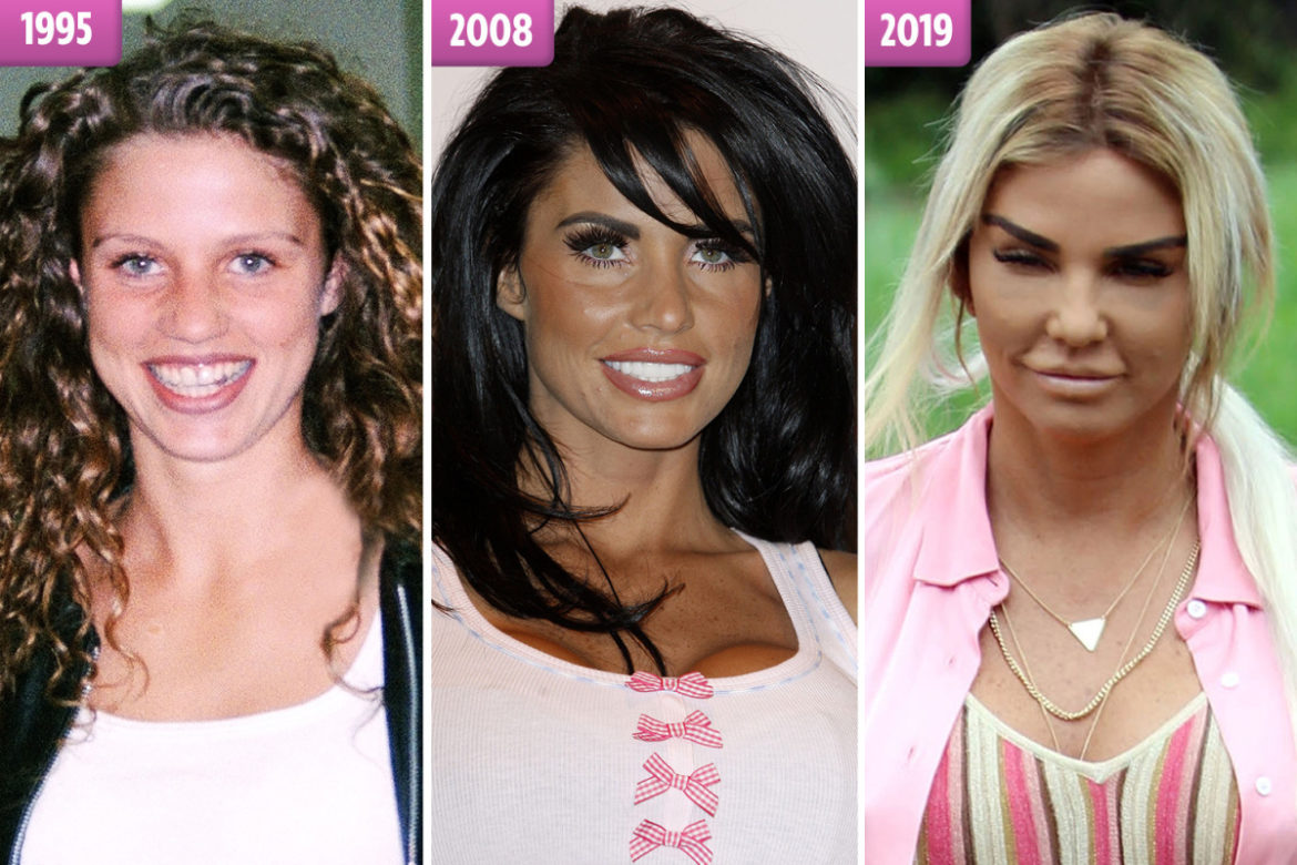 What Did Katie Price Used to Look Like