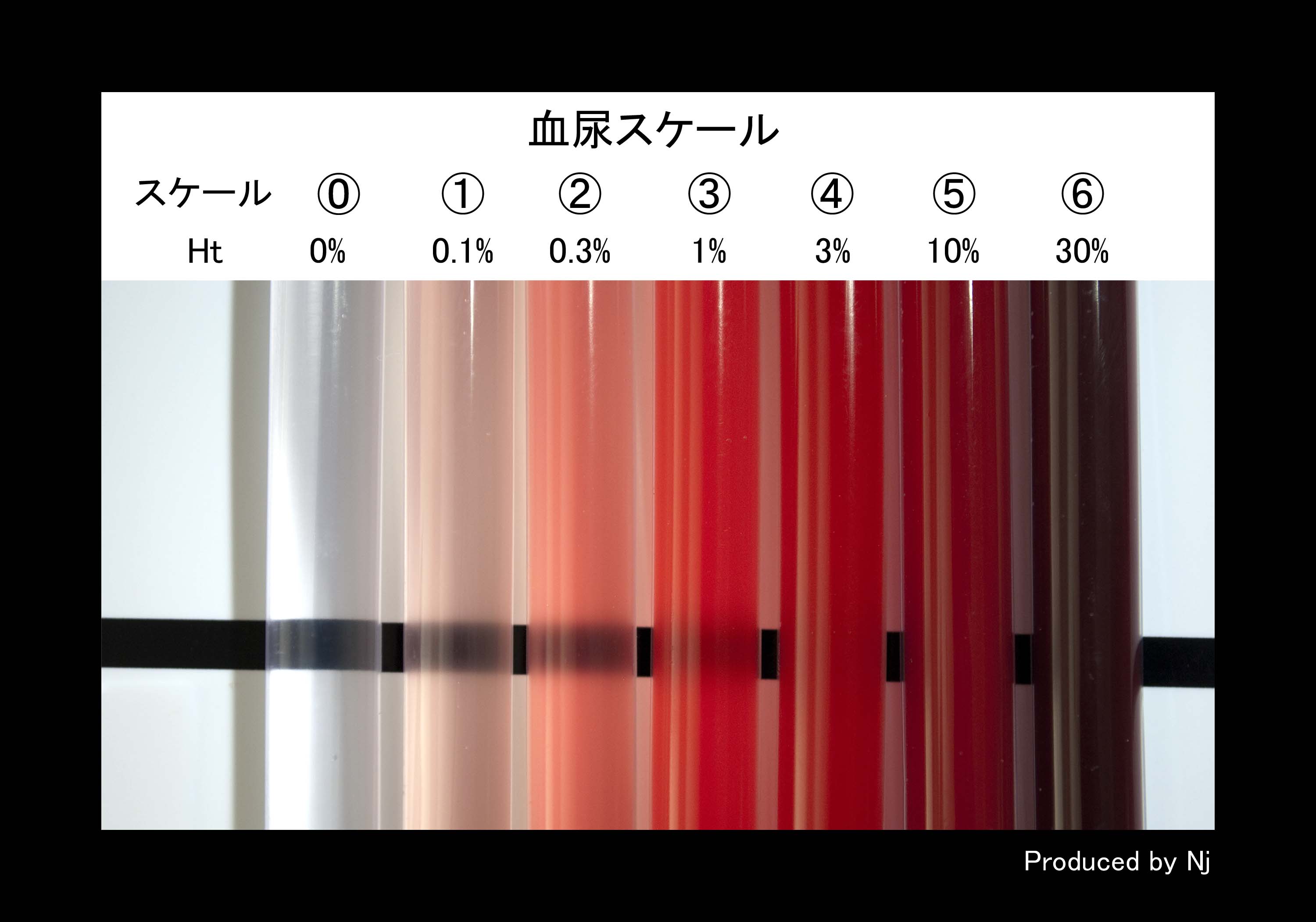 血尿スケールで見る危険度と色調基準｜緊急性の見極めと現場の対応策