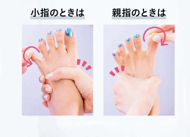 足の小指が横を向く寝指の真相！爪が小さい原因とプロ直伝の治し方