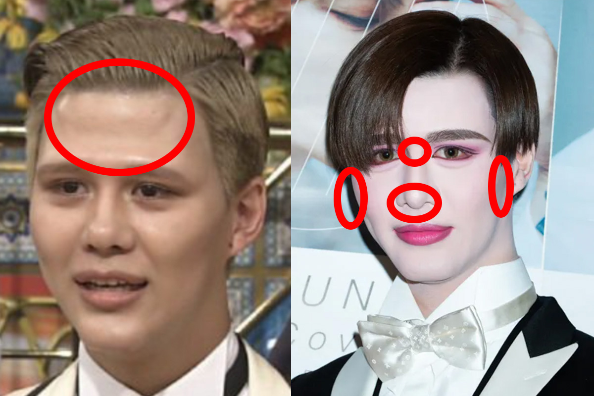 Mattの昔の顔と現在を徹底比較！整形疑惑やMatt化の真相