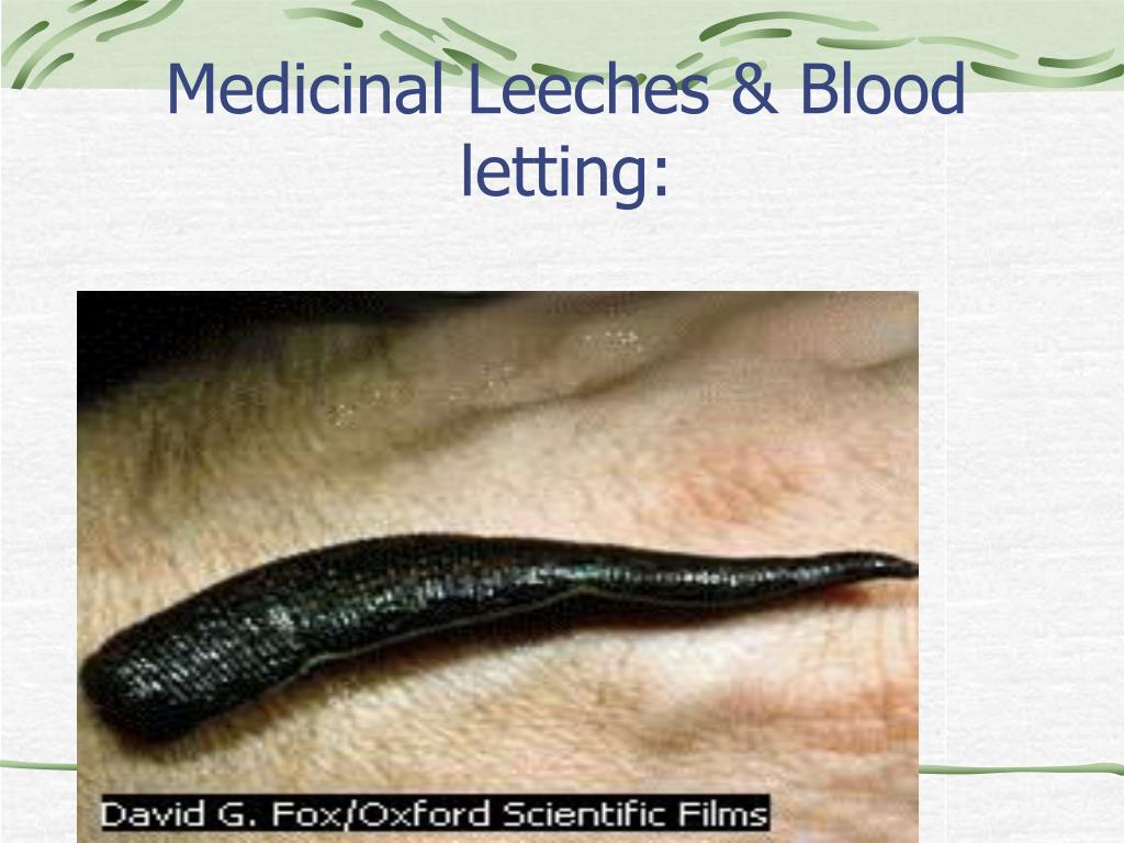 Can Leeches Transmit Disease