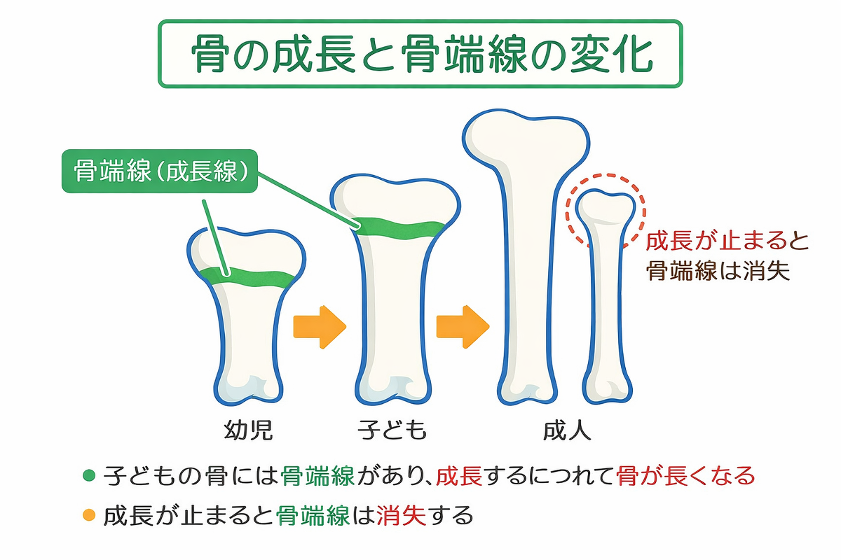 骨端線とは何歳で閉じる？レントゲン確認法と身長が伸びる限界の真相
