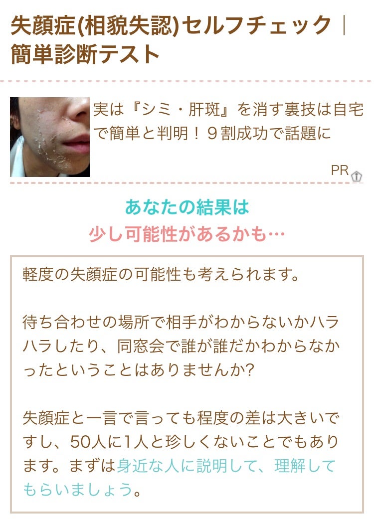 人の顔が覚えられないのは病気？相貌失認セルフチェックと脳の仕組み