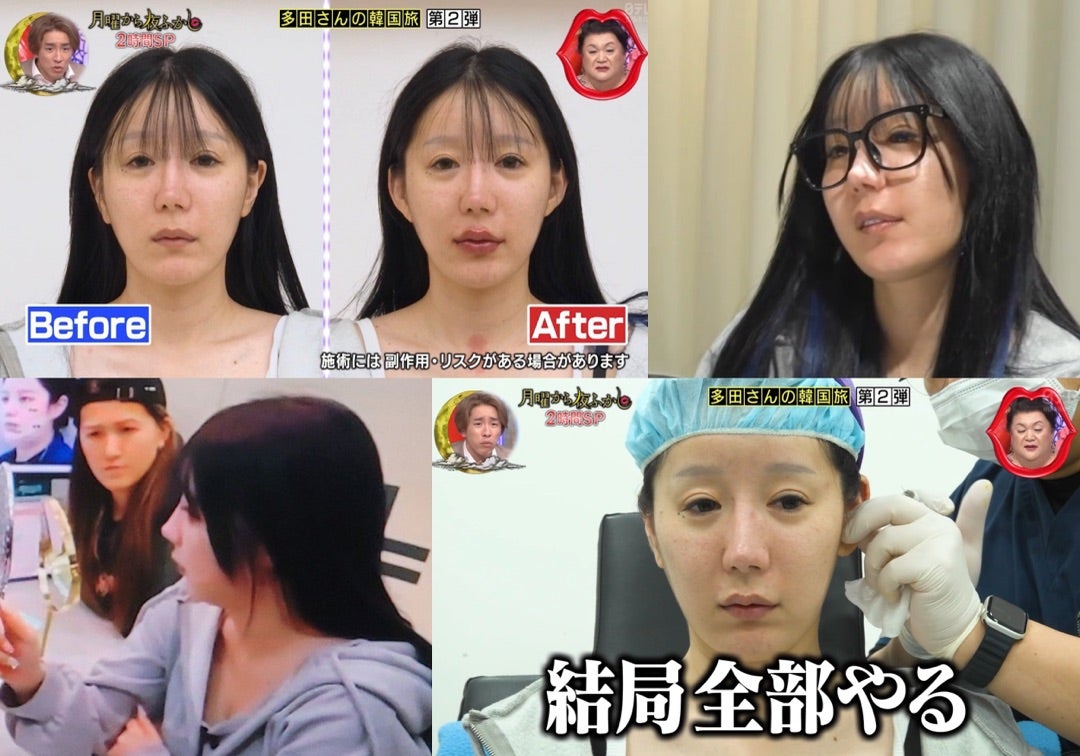 多田さんの整形前と現在を徹底比較！総額費用や理由、昔の素顔の真相