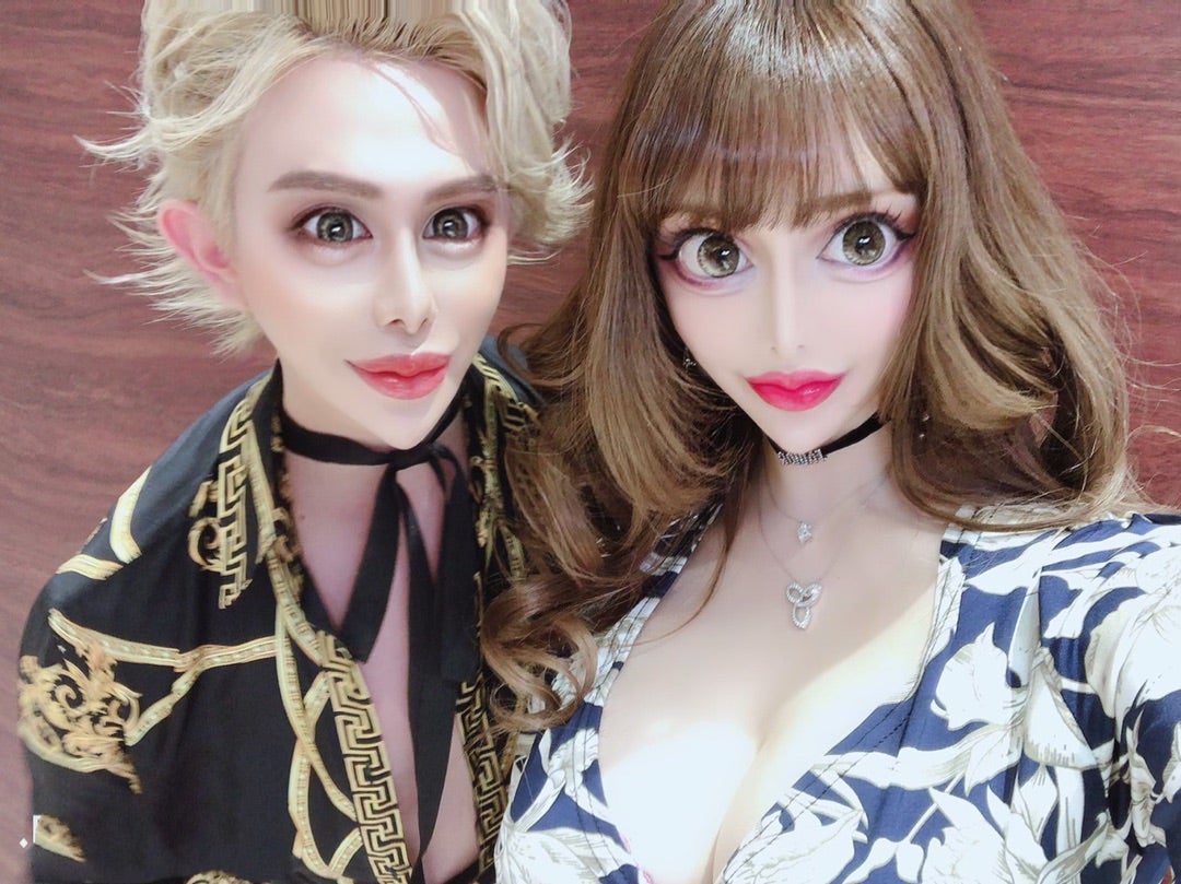 ヴァニラとアレン様の写真が語る現在｜整形前の素顔と不仲説の真相