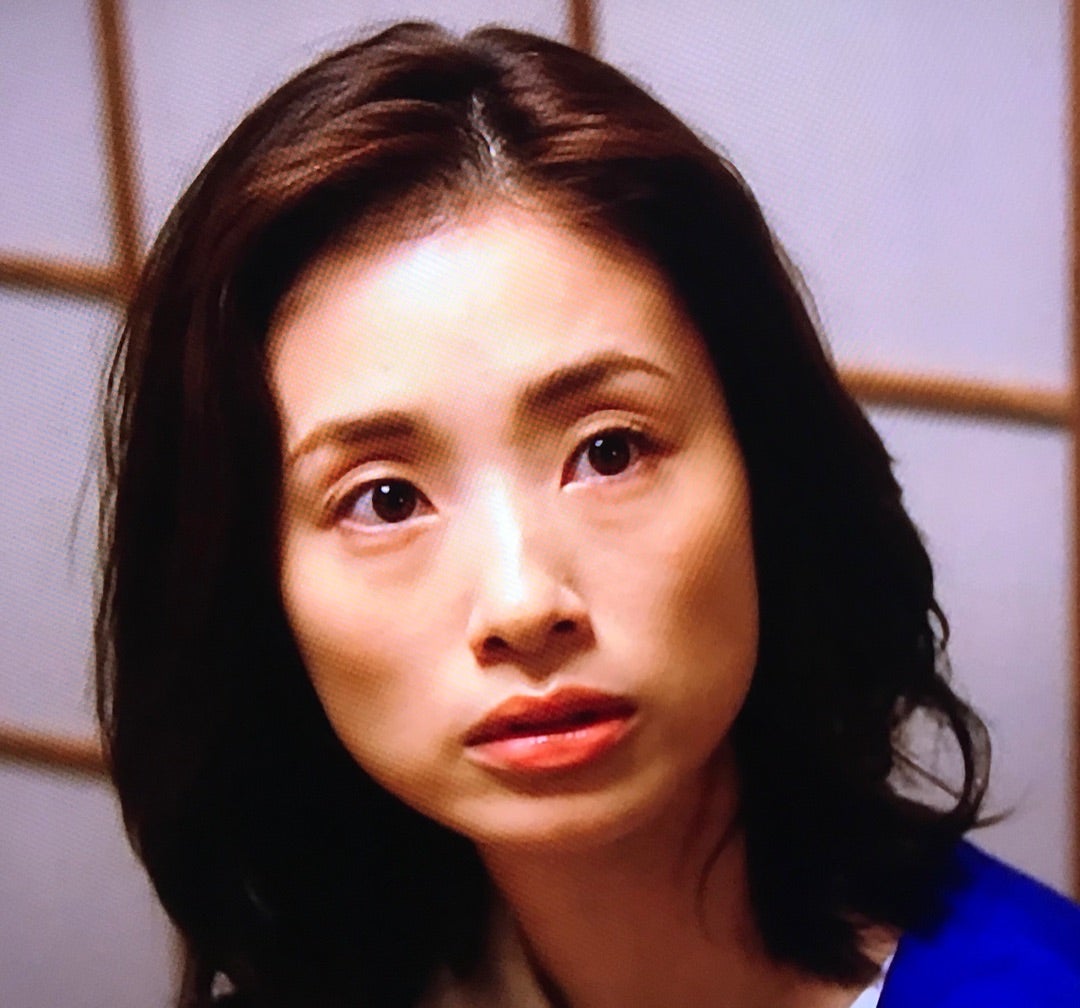 目のくぼみが気になる芸能人激変の理由とプロが明かす目元若返り術