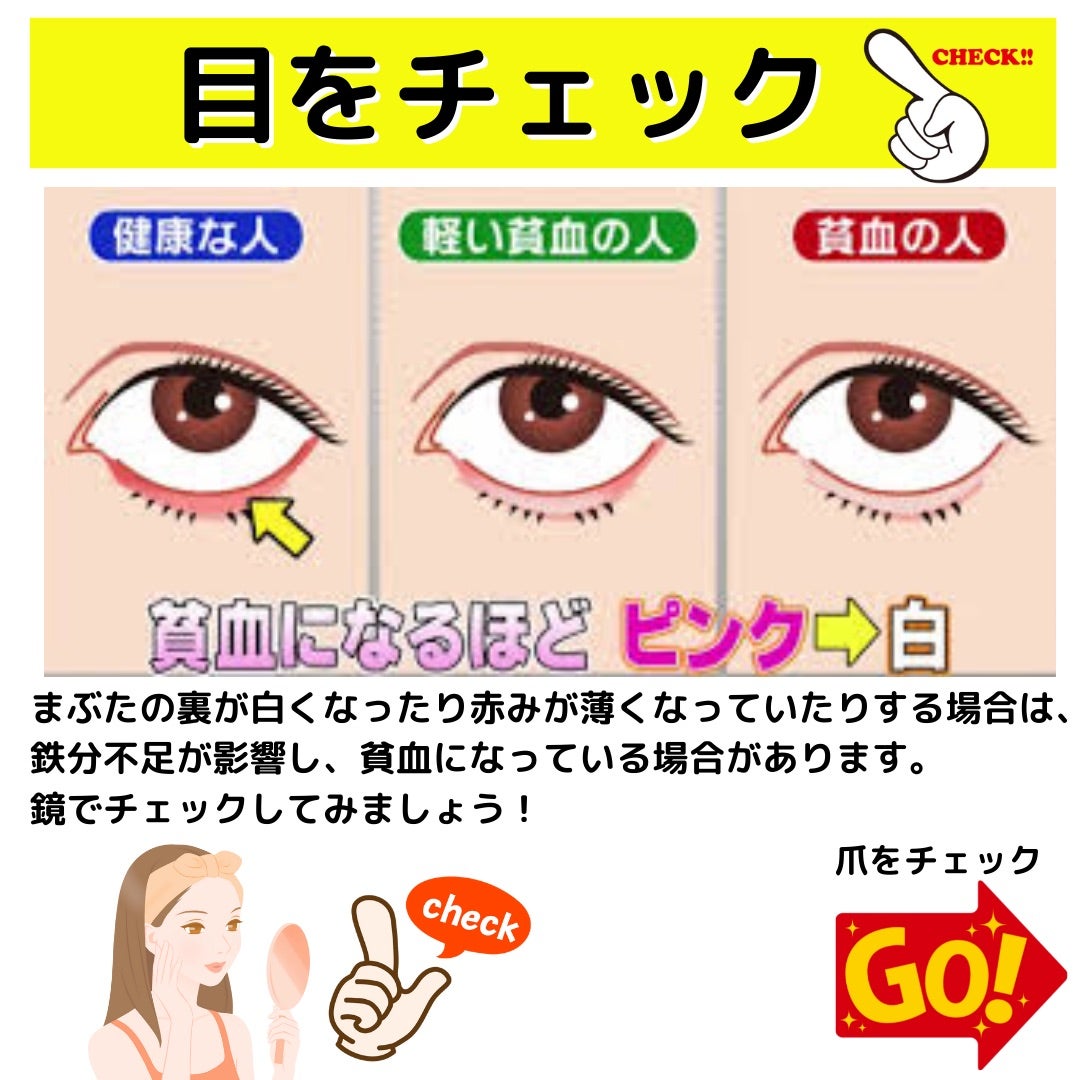 貧血のまぶたの色とは？裏が白い危険サインと写真比較セルフチェック