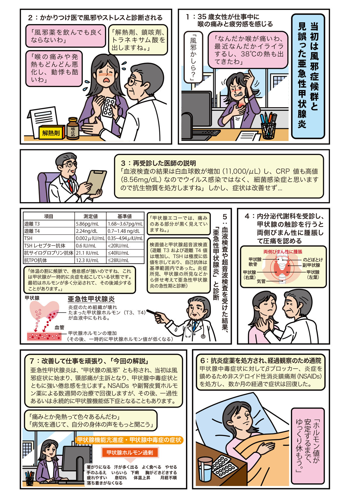 亜急性甲状腺炎はストレスが原因？首の痛みと発熱の真相を徹底解説