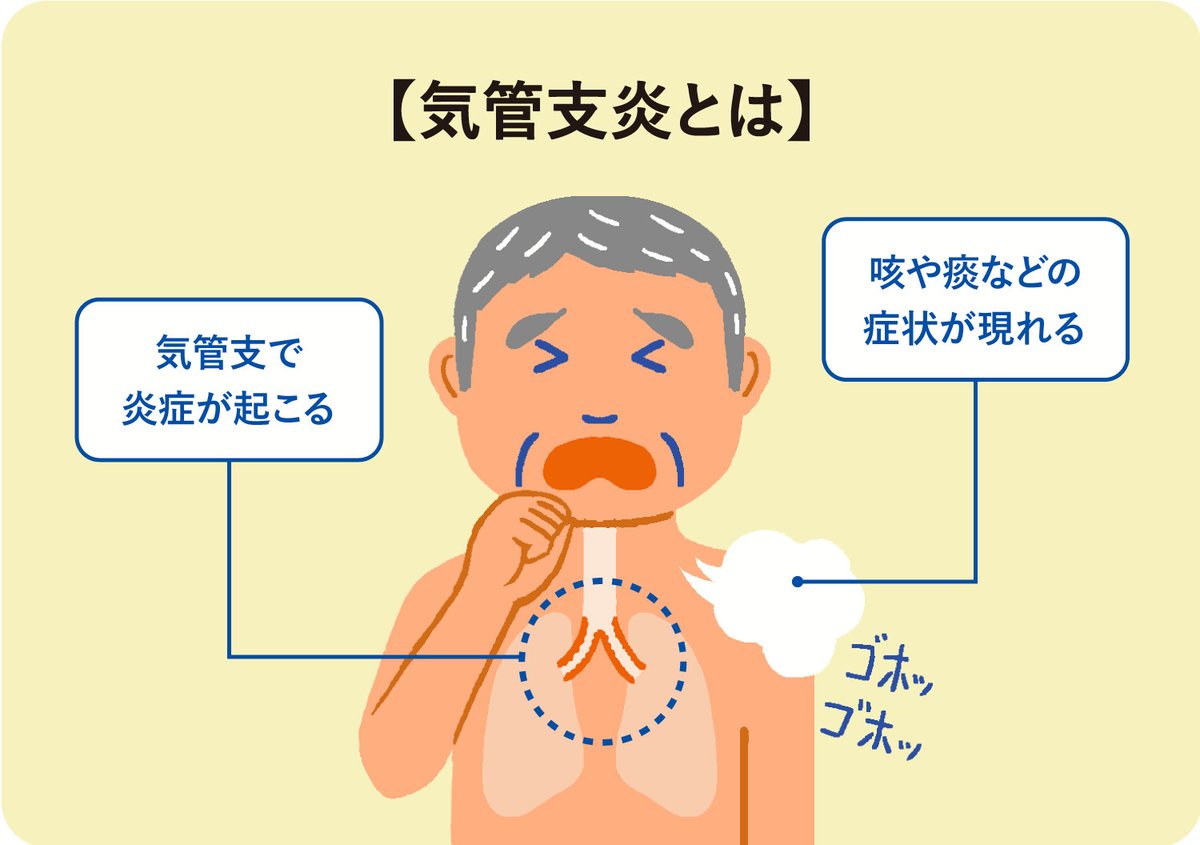 気管支炎の治し方完全ガイド｜長引く咳を早く止める正しい対処法